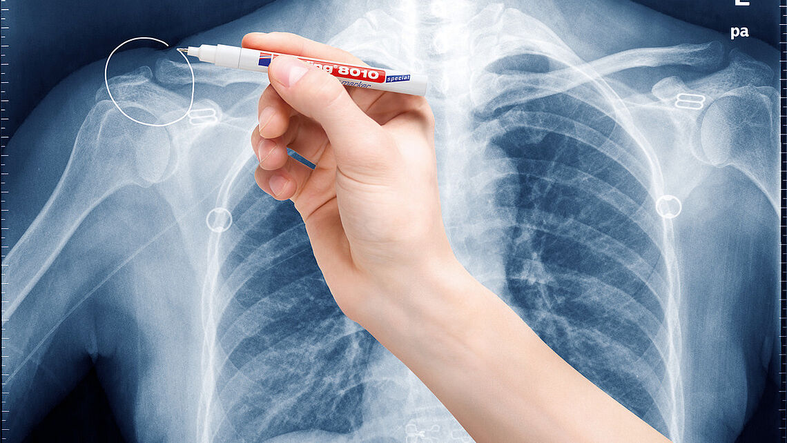 MARCADOR EDDING 8010 TINTA PERMANENTE EXTRA FINO EM IMAGEM RAIO X BRANCO 8010/49 2